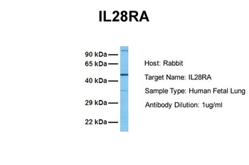 IL28RA Rabbit Polyclonal Antibody