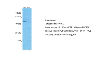 IL28RA Rabbit Polyclonal Antibody