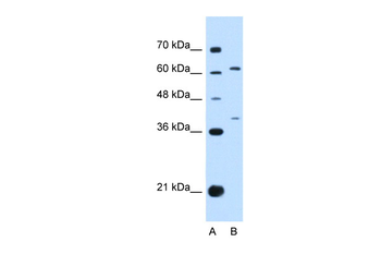 IL28RA Rabbit Polyclonal Antibody