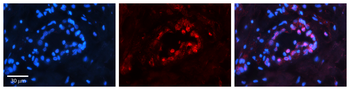 PAX8 Rabbit Polyclonal Antibody