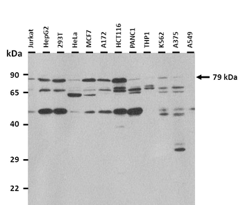 MAPT Rabbit Polyclonal Antibody