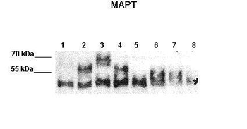 MAPT Rabbit Polyclonal Antibody