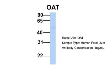 OAT Rabbit Polyclonal Antibody