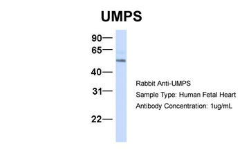 UMPS Rabbit Polyclonal Antibody