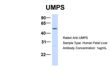 UMPS Rabbit Polyclonal Antibody