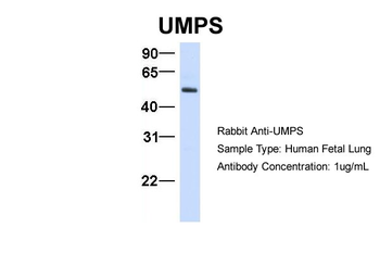 UMPS Rabbit Polyclonal Antibody