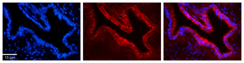 UMPS Rabbit Polyclonal Antibody