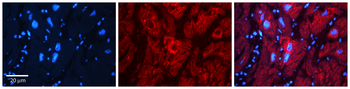 AK1 Rabbit Polyclonal Antibody