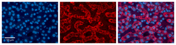 ACAA1 Rabbit Polyclonal Antibody