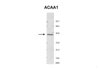 ACAA1 Rabbit Polyclonal Antibody