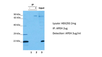 APEH Rabbit Polyclonal Antibody