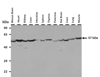 ATP5F1B Rabbit Polyclonal Antibody