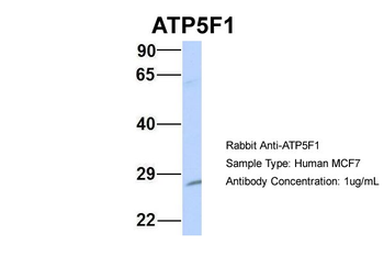 ATP5PB Rabbit Polyclonal Antibody