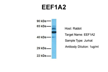 EEF1A2 Rabbit Polyclonal Antibody