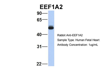 EEF1A2 Rabbit Polyclonal Antibody