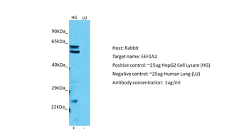 EEF1A2 Rabbit Polyclonal Antibody