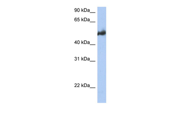 BAG3 Rabbit Polyclonal Antibody