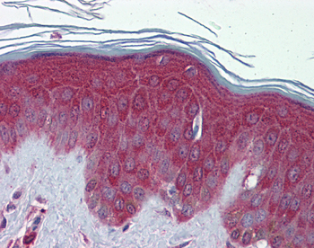 PRDX6 Rabbit Polyclonal Antibody