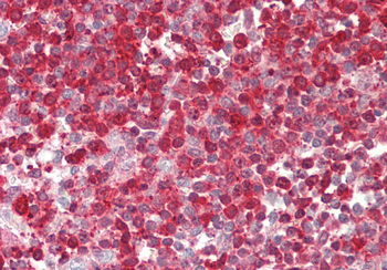 PFN1 Rabbit Polyclonal Antibody