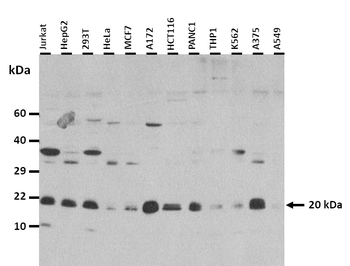 MYL9 Rabbit Polyclonal Antibody
