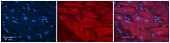 PHB2 Rabbit Polyclonal Antibody