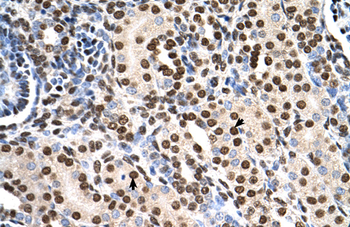 RSU1 Rabbit Polyclonal Antibody