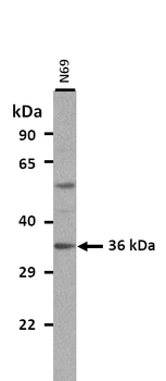 TTC35 Rabbit Polyclonal Antibody