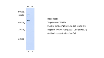 WDR34 Rabbit Polyclonal Antibody