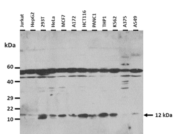ATP5IF1 Rabbit Polyclonal Antibody