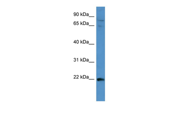 MAP3K15 Rabbit Polyclonal Antibody