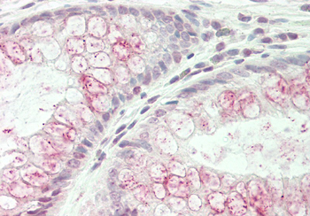 WNK3 Rabbit Polyclonal Antibody