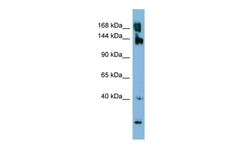 WNK3 Rabbit Polyclonal Antibody