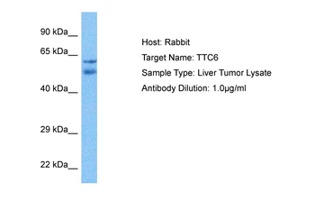 TTC6 Rabbit Polyclonal Antibody