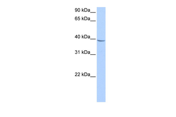 NUDT17 Rabbit Polyclonal Antibody
