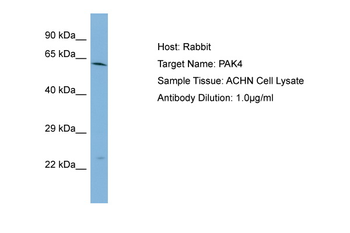 PAK4 Rabbit Polyclonal Antibody