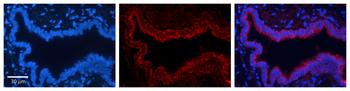 TKT Rabbit Polyclonal Antibody