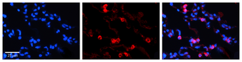 TKT Rabbit Polyclonal Antibody