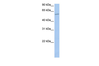 MBOAT1 Rabbit Polyclonal Antibody