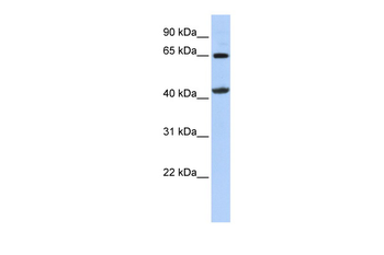 GATM Rabbit Polyclonal Antibody