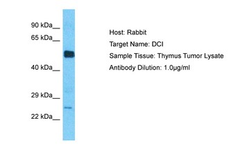 ECI1 Rabbit Polyclonal Antibody