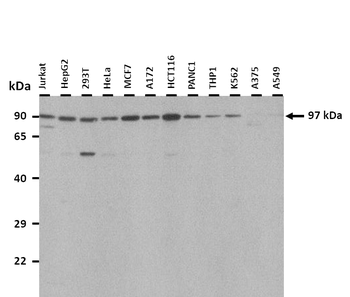 PYGB Rabbit Polyclonal Antibody