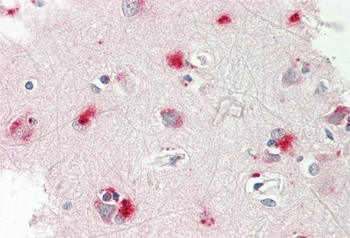 PYGB Rabbit Polyclonal Antibody