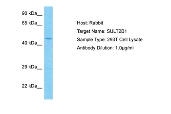 SULT2B1 Rabbit Polyclonal Antibody