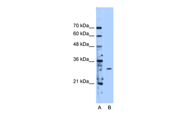 METTL1 Rabbit Polyclonal Antibody
