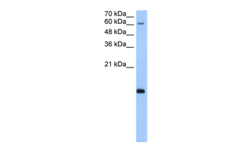 POLR2H Rabbit Polyclonal Antibody