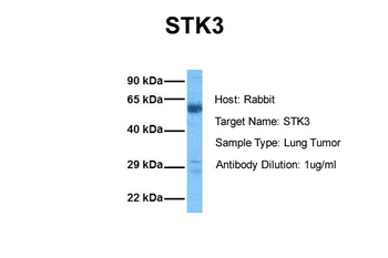 STK3 Rabbit Polyclonal Antibody