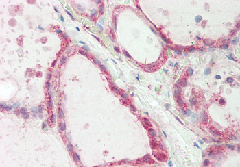 ATE1 Rabbit Polyclonal Antibody