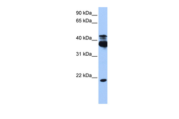 STK38 Rabbit Polyclonal Antibody