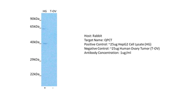 QPCT Rabbit Polyclonal Antibody