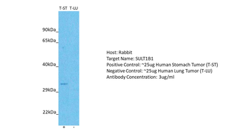 SULT1B1 Rabbit Polyclonal Antibody
